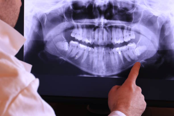 Best Emergency Tooth Extraction  in Rumson, NJ
