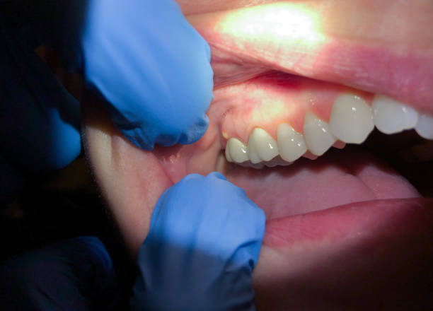 Best Broken Tooth Emergency  in Rumson, NJ